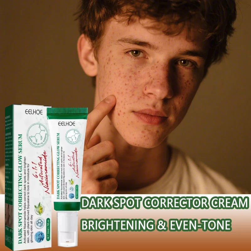 Dark Spot Corrector Cream Reduces Dark Spots Brightening Care Hydrates and Nourishes Skin Reduces Melanin Fades Spots Freckles