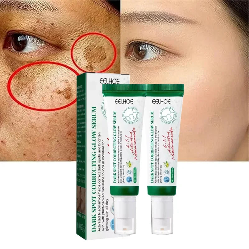 Dark Spot Corrector Cream Reduces Dark Spots Brightening Care Hydrates and Nourishes Skin Reduces Melanin Fades Spots Freckles