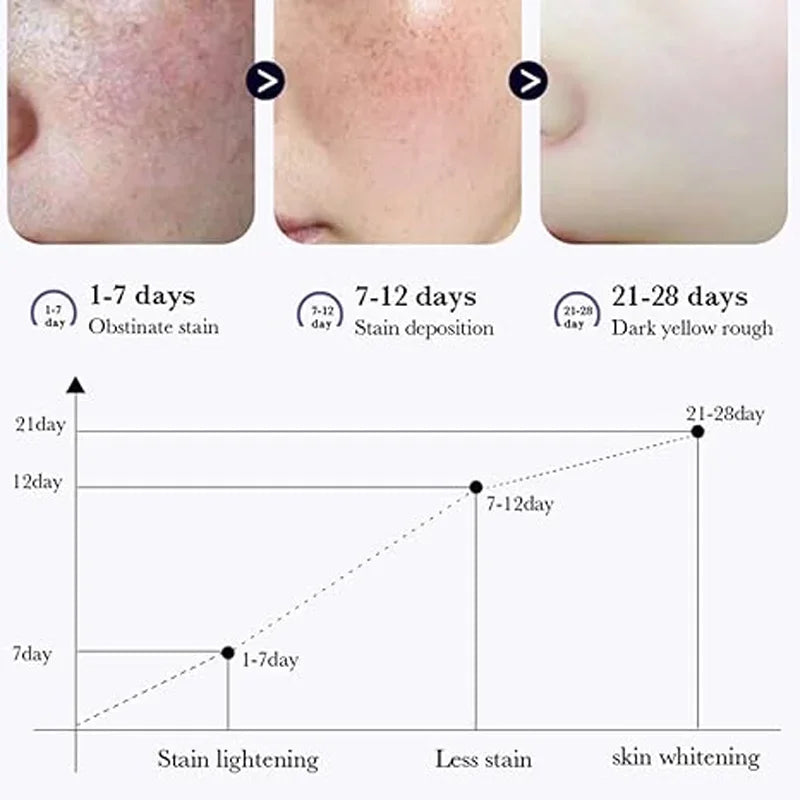 Dark Spot Corrector Cream Reduces Dark Spots Brightening Care Hydrates and Nourishes Skin Reduces Melanin Fades Spots Freckles