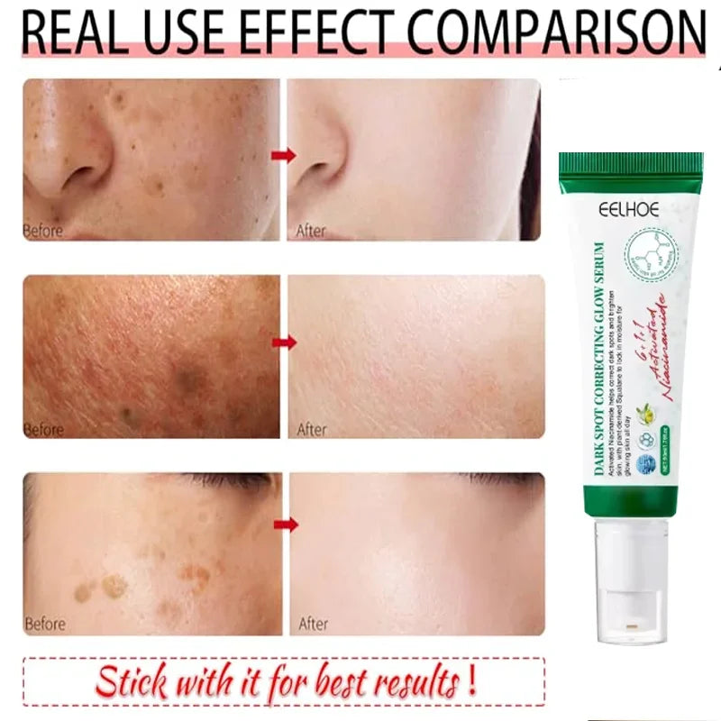 Dark Spot Corrector Cream Reduces Dark Spots Brightening Care Hydrates and Nourishes Skin Reduces Melanin Fades Spots Freckles